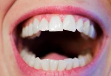 השתלת שיניים בתל אביב