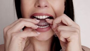 יישור שיניים אינויזליין